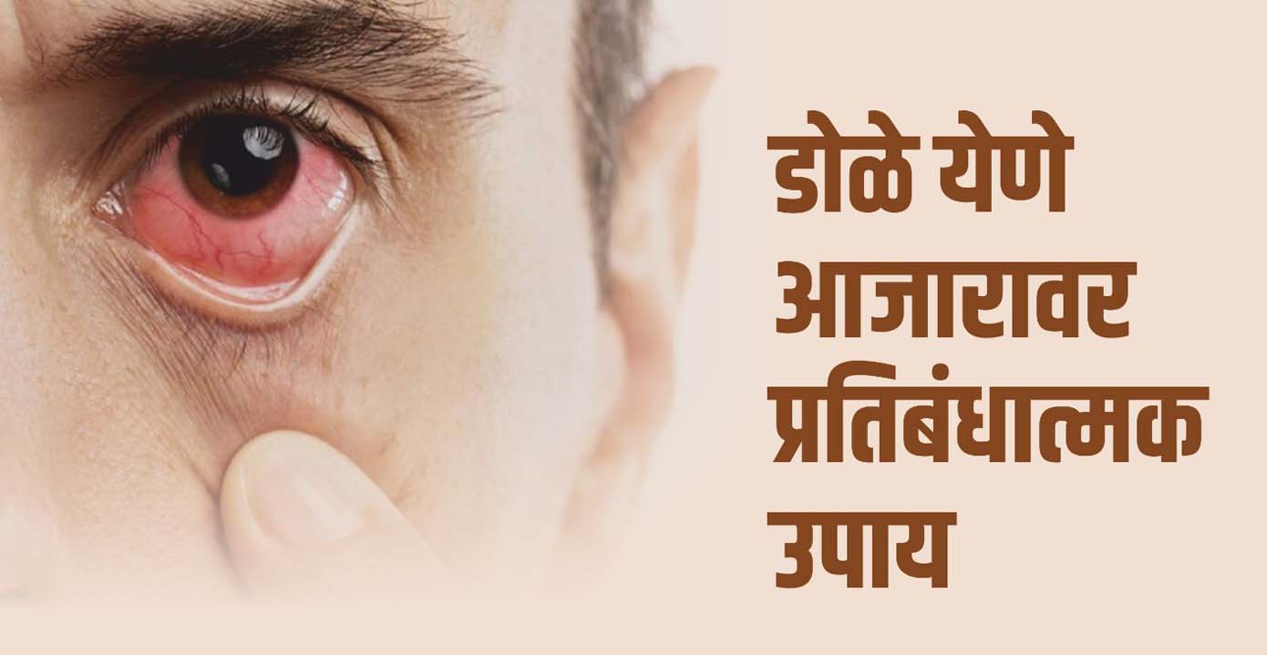 डोळे येण्याच्या संसर्गावर वारंवार हात धुण्याच्या सवयीने प्रतिबंध करा; आरोग्य विभागाचे आवाहन