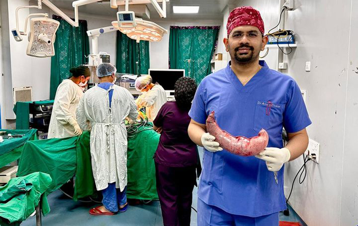 ससून रुग्णालयात लठ्ठपणा कमी करण्याची बॅरिएट्रिक शस्त्रक्रिया यशस्वी