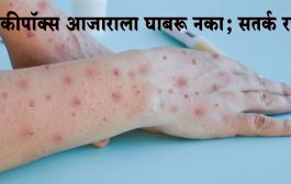 मंकीपॉक्स आजाराला घाबरू नका; सतर्क रहा, आरोग्य विभागाकडून सूचना जारी