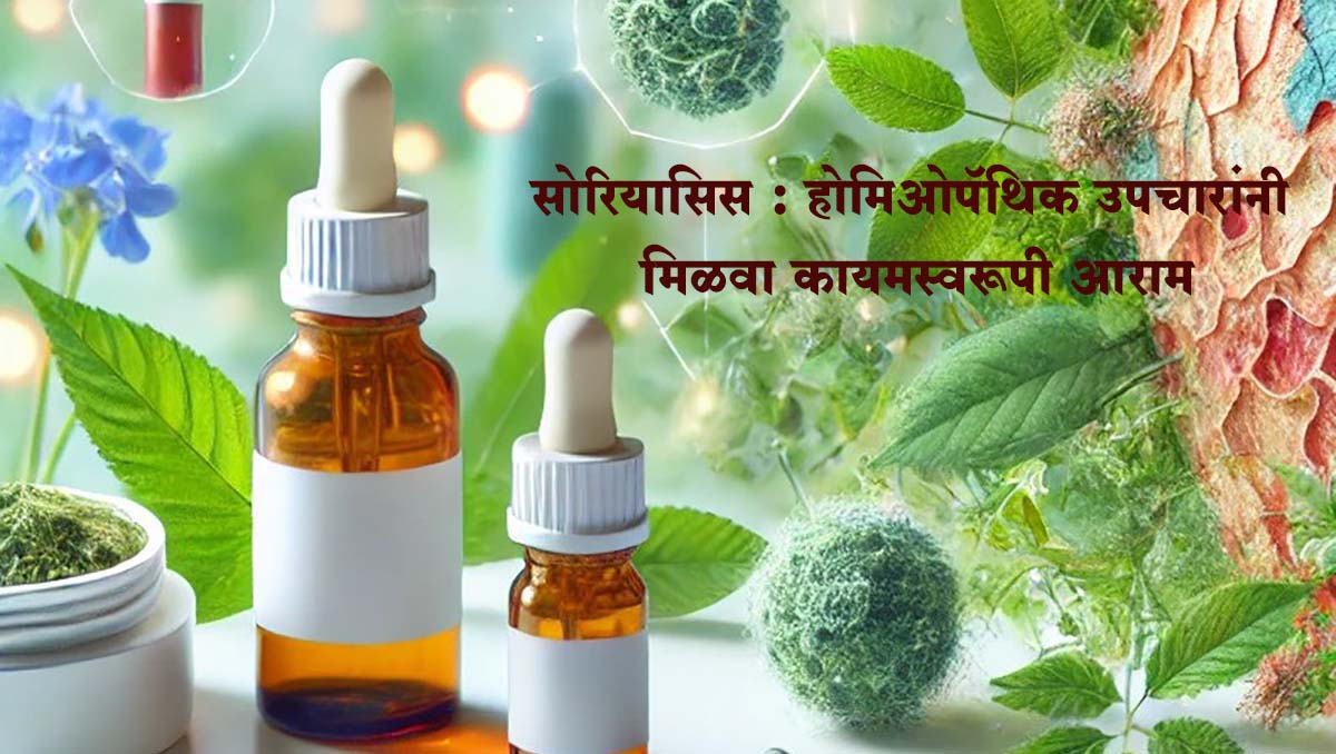 Health । सोरियासिस आणि होमिओपॅथिक उपचार
